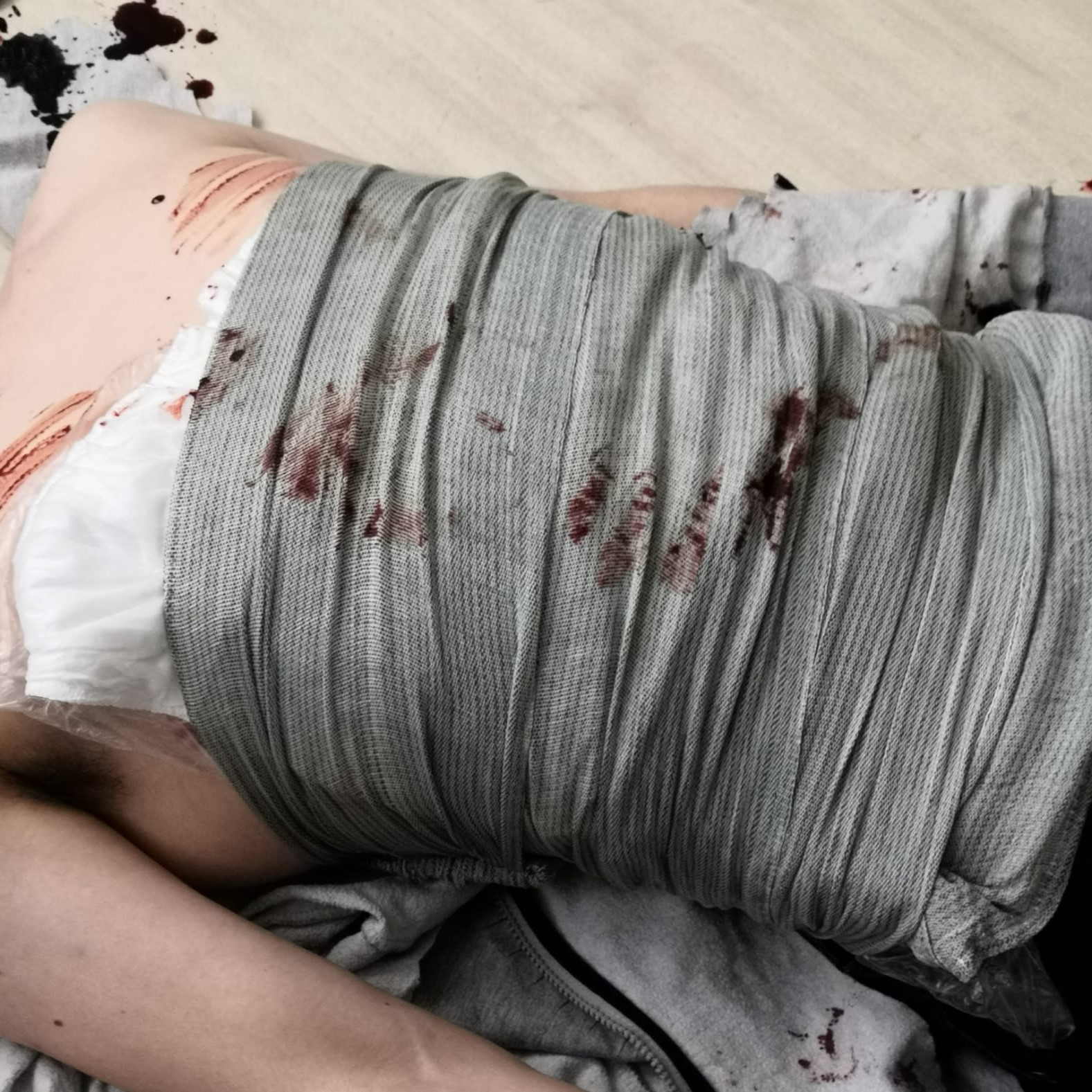 8'' Abdominal Bandage