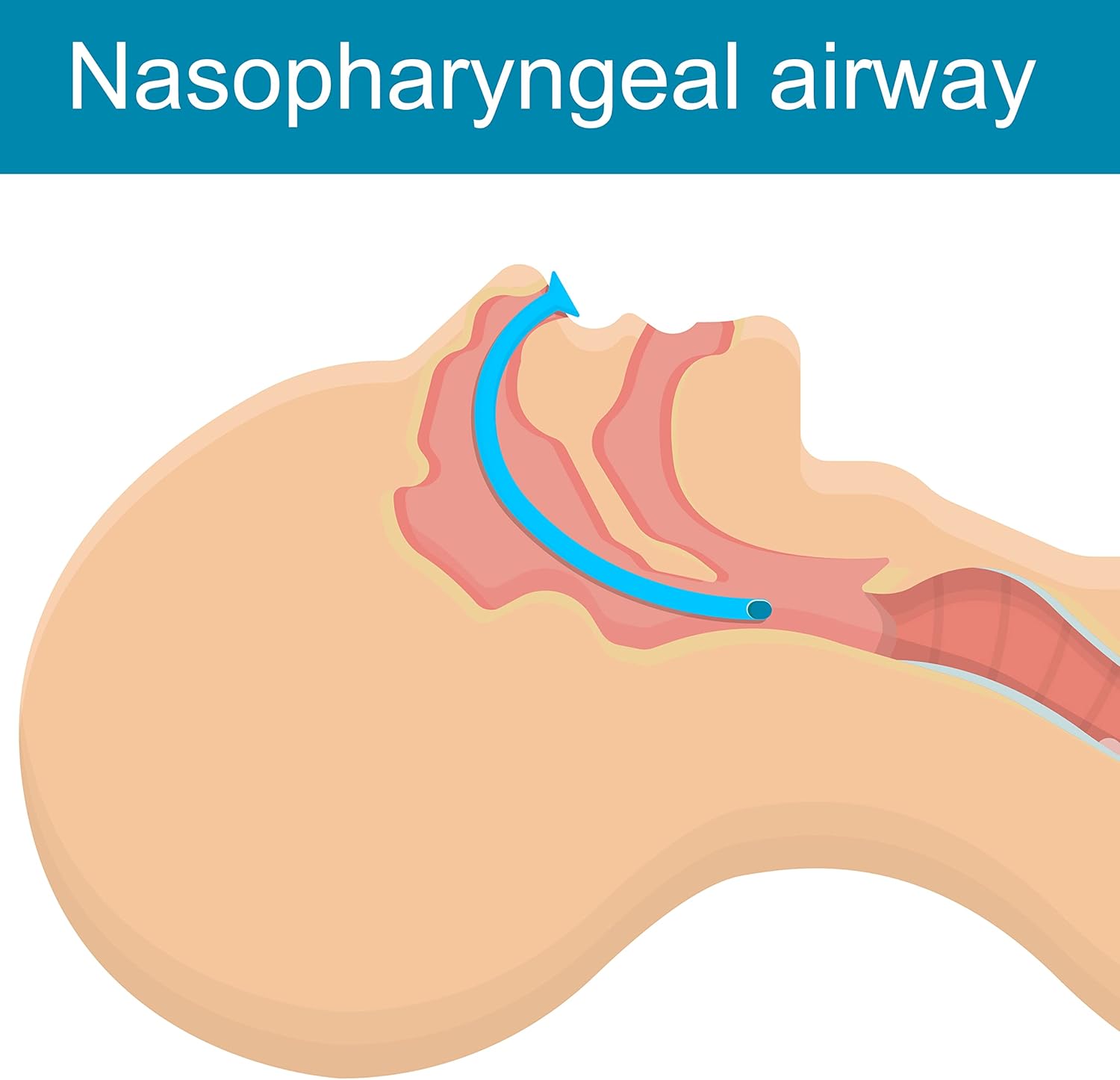 PVC Nasopharyngeal Airway+Connector