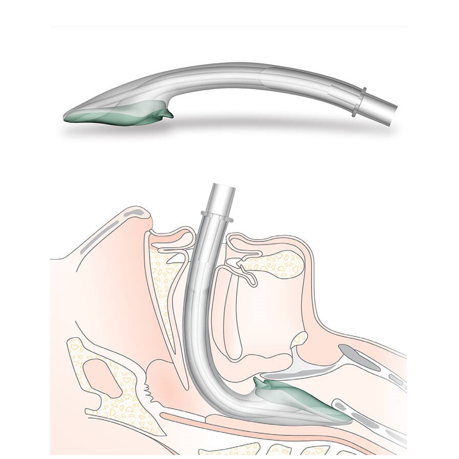 i-gel® Supraglottic Airway
