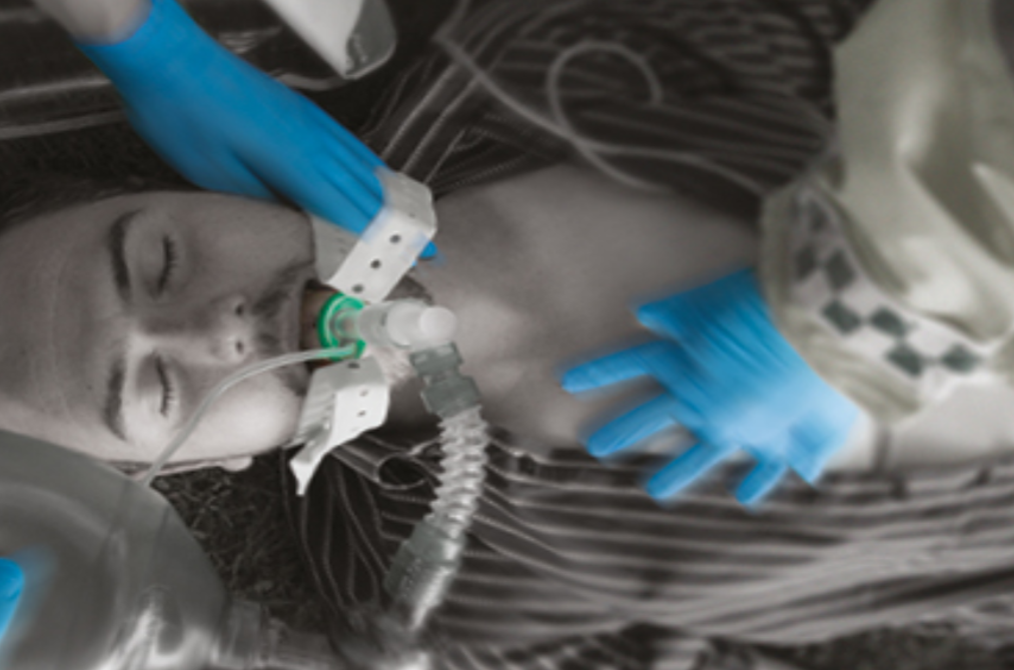i-gel® Supraglottic Airway