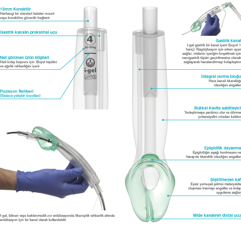 i-gel® Supraglottic Airway