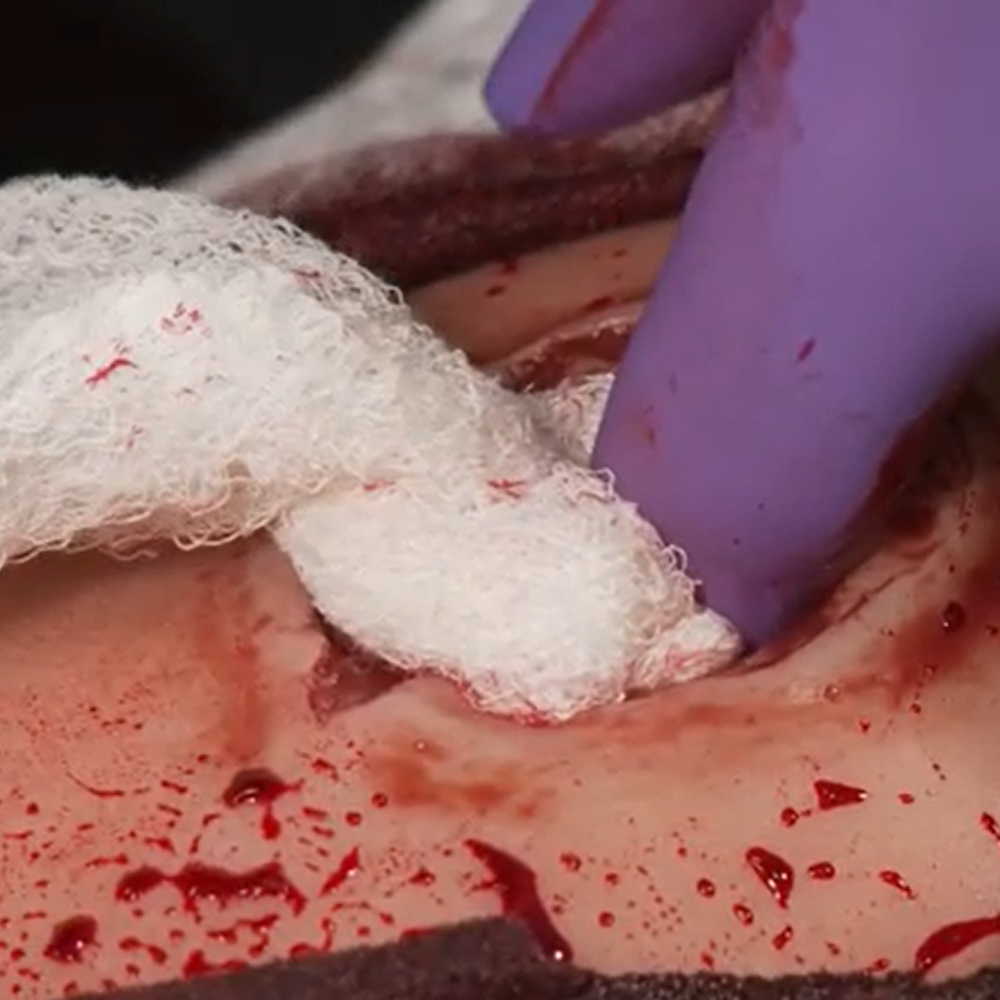 Compressed Gauze