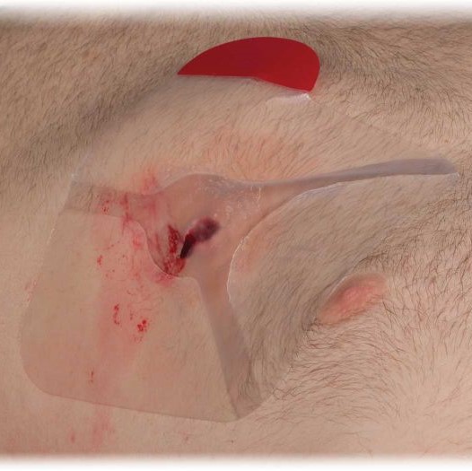 Chest Seal Vented (Hyfin)