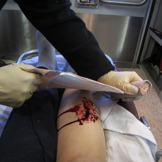 Tytek 6'' Trauma Bandage