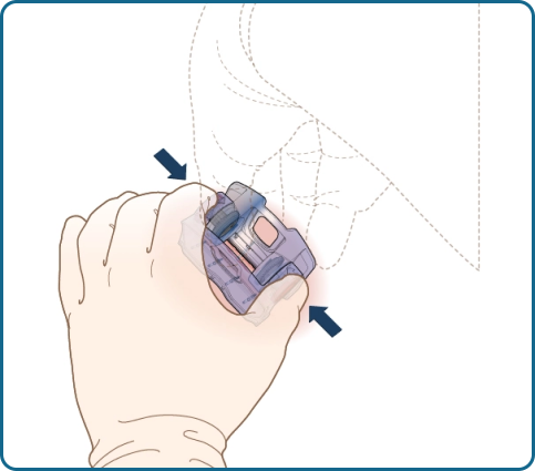 The iTClamp® Hemorrhage Control System